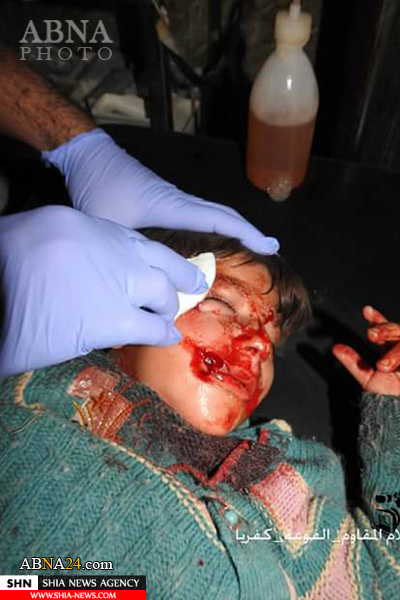 زخمی شدن ۲۲ شیعه در حمله خمپاره ای به فوعه و کفریا