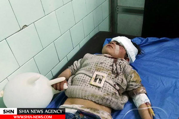 بسته‌های چیپس قاتل کودکان بی‌گناه فوعه و کفریا