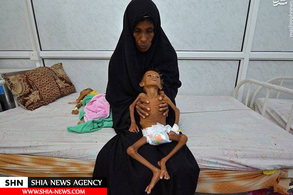 آماری از خسارت‌های جنگ سه ساله یمن در حوزه بهداشت و درمان+ تصاویر