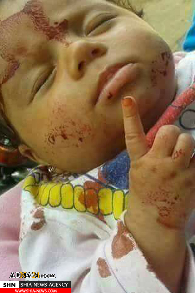 تصاویر نسل کشی شیعیان در میرزا اولنگ افغانستان تصاویر نسل کشی شیعیان در میرزا اولنگ افغانستان