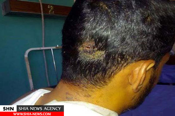 نجات معجزه آسا از دست داعش به روایت شهید زنده عراقی+ تصویر