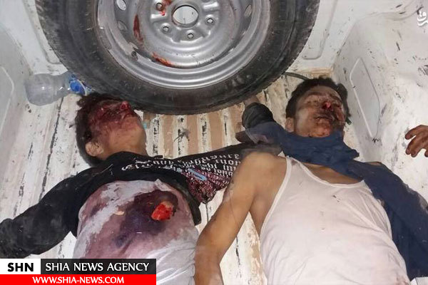 سیلی شیعیان الزهرا به تروریست‌ها+ تصاویر