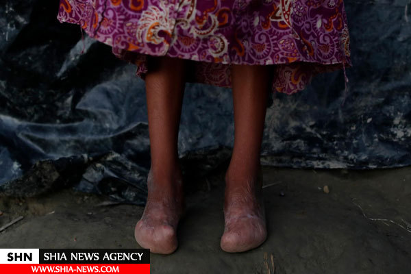 تصاویر بهت‌آور رویترز از آثار گلوله و سوختگی روی تن غیرنظامیان روهینگیا