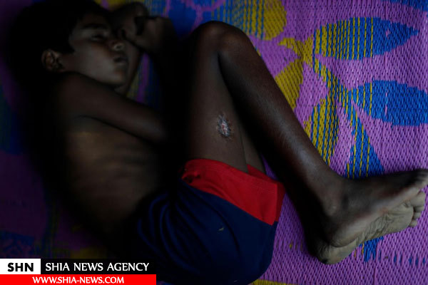 تصاویر بهت‌آور رویترز از آثار گلوله و سوختگی روی تن غیرنظامیان روهینگیا