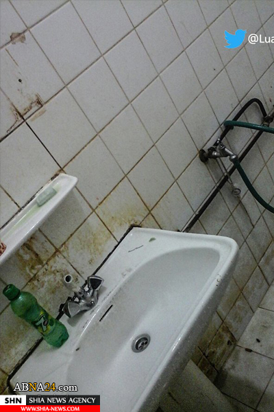 وضع وخیم بهداشت در زندان جو رژیم آل خلیفه