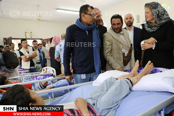 مظلومیت کودکان یمنی اشک مقام سازمان ملل را هم در آورد+ تصاویر