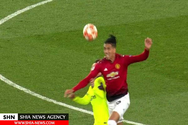 مصدومیت خونین مسی مقابل منچستریونایتد+ تصاویر