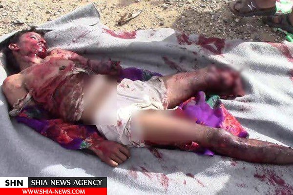 انتشار تصاویر اجساد تکه شده مردم یمن در حمله سعودی در ماه رمضان