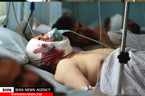 تصاویر انفجار&zwnj;های خونین در کابل