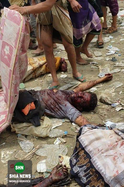 تصاویر دلخراش از حمله خونین جنگنده‌های سعودی به بازاری در صعده