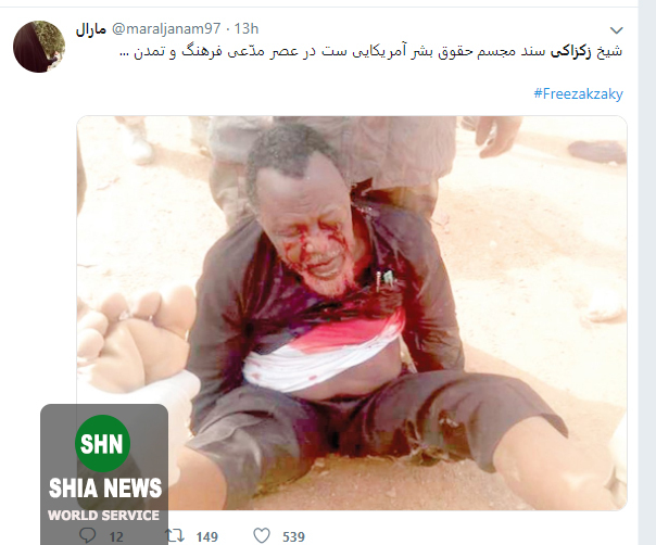 زکزکی را در بند کردید تفکر او را چه می&zwnj;کنید؟ + تصاویر