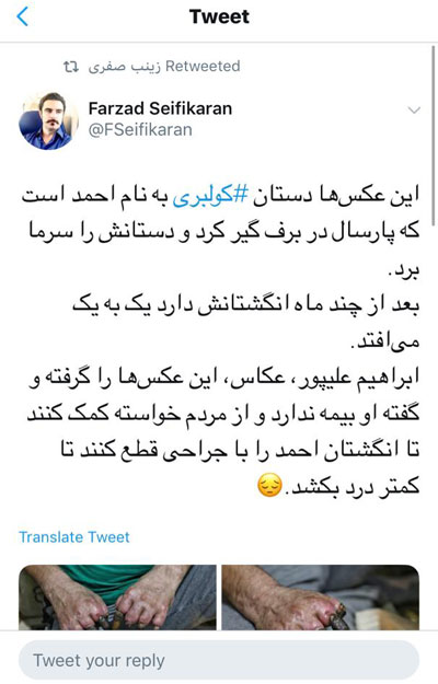 تصاویر دلخراش از وضعیت یک کولبر (۱۸+) تصاویر دلخراش از وضعیت یک کولبر (۱۸+)