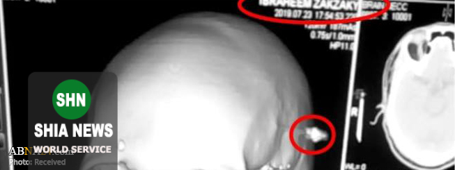 تصاویر جدید از رهبر جنبش اسلامی نیجریه