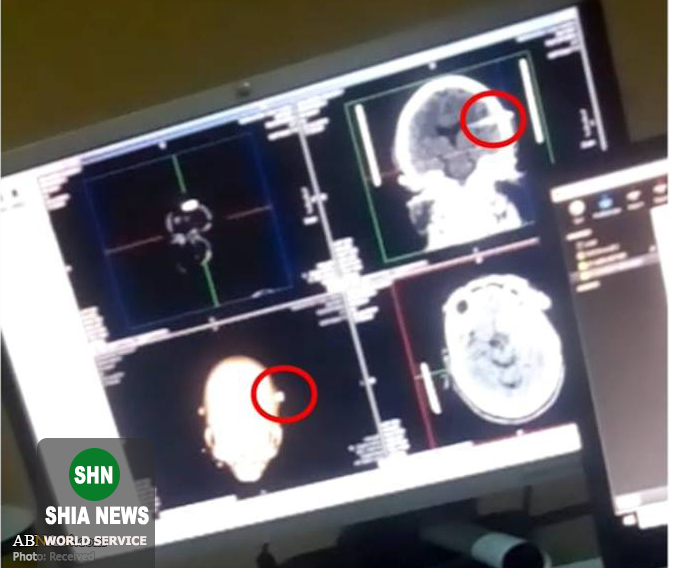 تصاویر جدید از رهبر جنبش اسلامی نیجریه