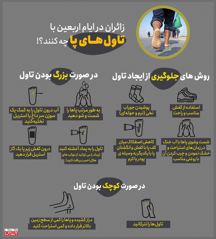 زائران در ایام اربعین با تاول های پا چه کنند؟! زائران در ایام اربعین با تاول های پا چه کنند؟!