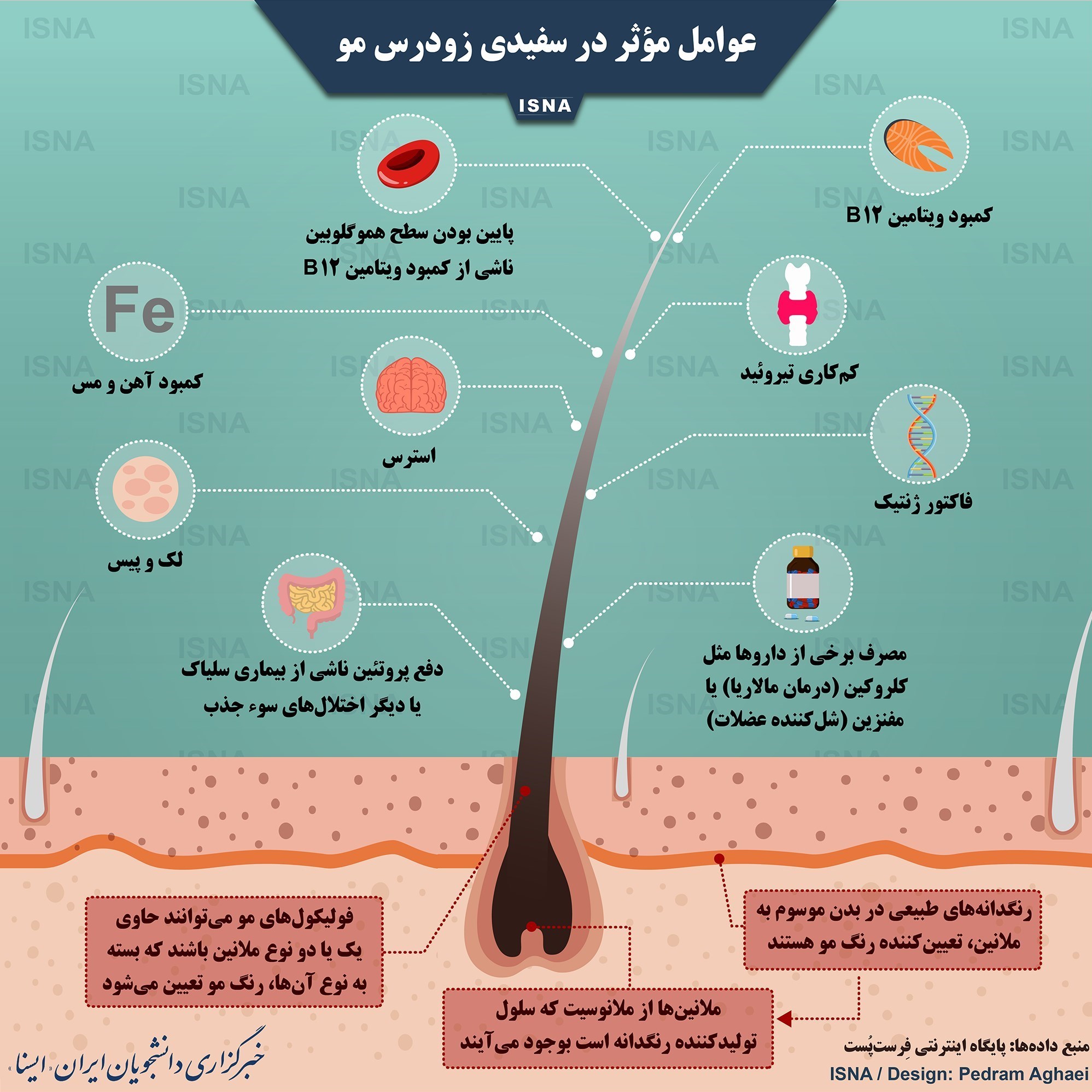 عوامل مؤثر در سفیدی زودرس مو عوامل مؤثر در سفیدی زودرس مو