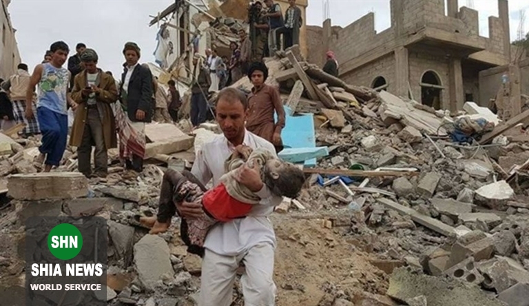 کودکان یمنی قربانی جنگ