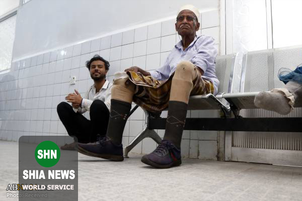 مرکز ساخت دست و پای مصنوعی برای جنگ زده‌های یمنی