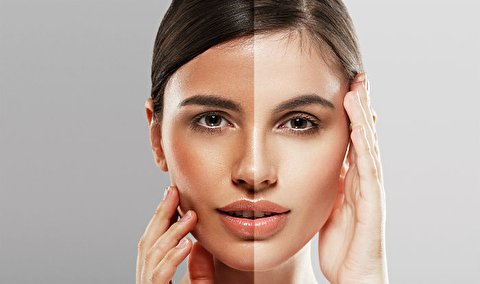 دلایل نداشتن پوست خوب دلایل نداشتن پوست خوب