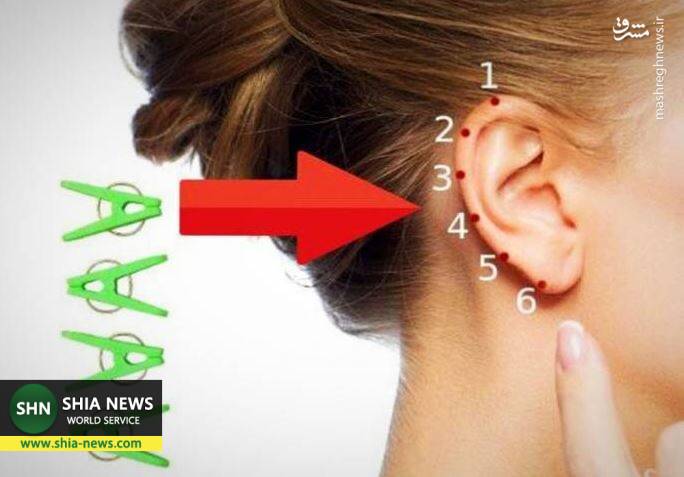تسکین دردها با فشار دادن نقطه ای خاص روی گوش تسکین دردها با فشار دادن نقطه ای خاص روی گوش