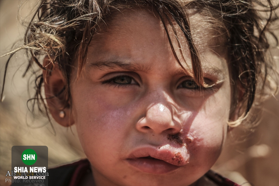 سالک بلای جان کودکان آواره سوری