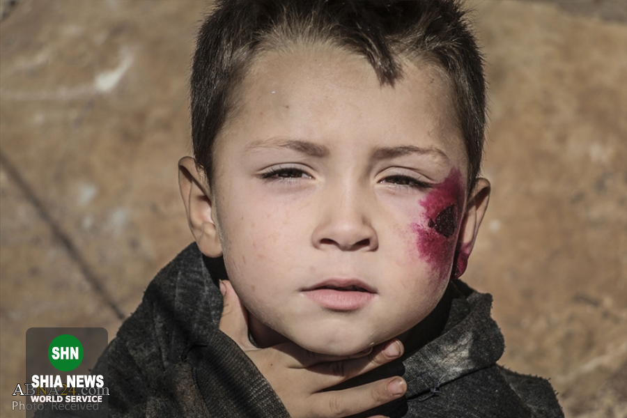 سالک بلای جان کودکان آواره سوری