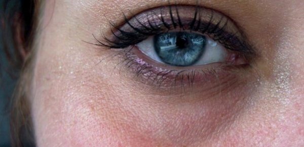 ۶ علت تیرگی زیر چشم‌ها