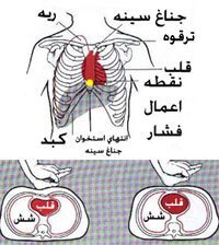 آموزش احیاء قلبی ریوی به روش اورژانسی(CPR)