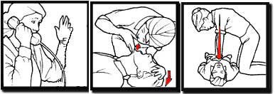آموزش احیاء قلبی ریوی به روش اورژانسی(CPR)