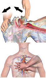 آموزش احیاء قلبی ریوی به روش اورژانسی(CPR)