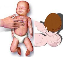 آموزش احیاء قلبی ریوی به روش اورژانسی(CPR)