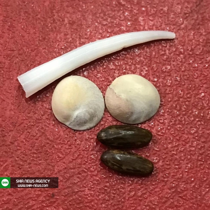 عجیب&zwnj;ترین نماد&zwnj;های خوش&zwnj;شانسی در جهان