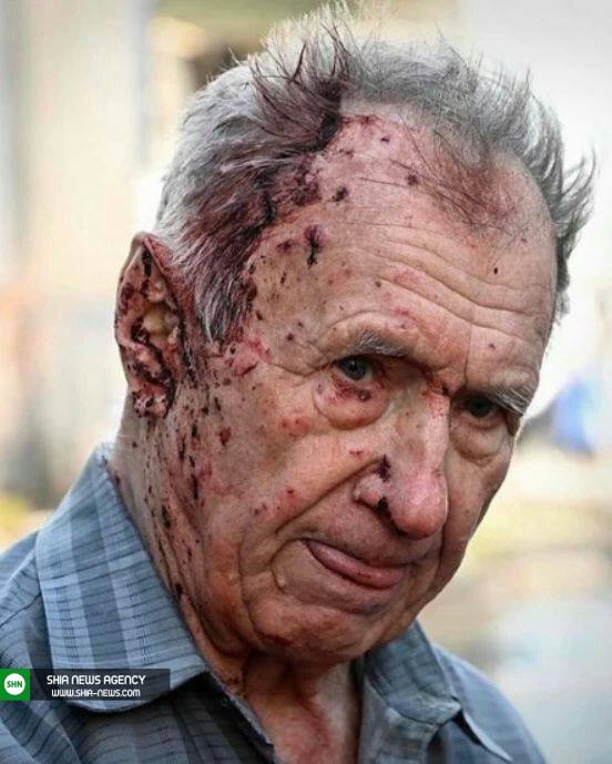 تصاویری از جنایات ضدبشری متجاوزان روسیه در حق مردم اوکراین تصاویری از جنایات ضدبشری متجاوزان روسیه در حق مردم اوکراین