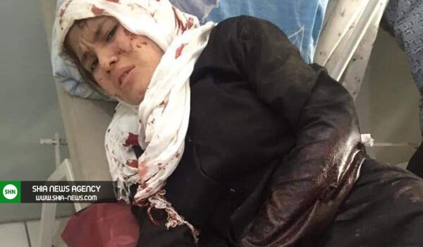 انفجار تروریستی خونین در دبیرستان دخترانه در محله شیعه نشین کابل