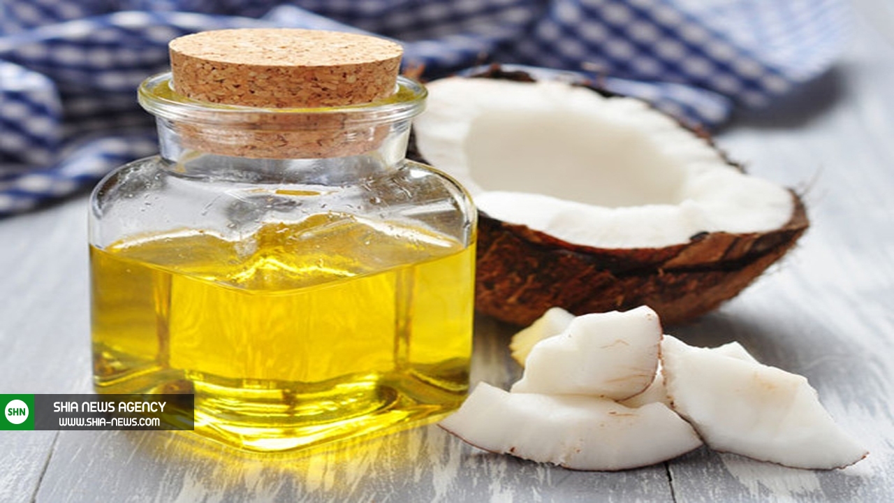 شپش موی سر و درمان سریع و قطعی آن شپش موی سر و درمان سریع و قطعی آن