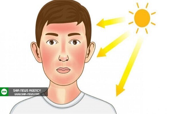 آثار مثبت و مضرات نور آفتاب برای سلامتی بدن