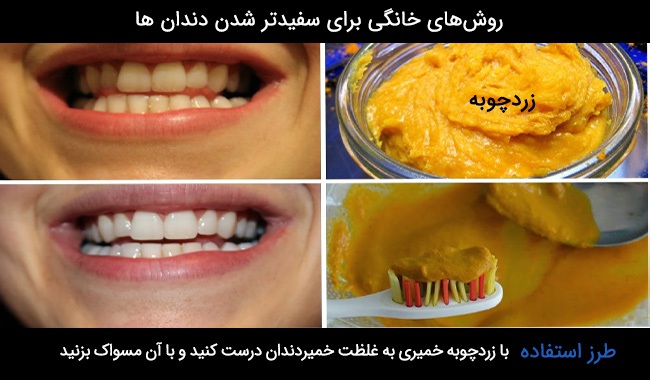 روش های طبیعی برای سفید کردن دندان ها چیست؟ روش های طبیعی برای سفید کردن دندان ها چیست؟