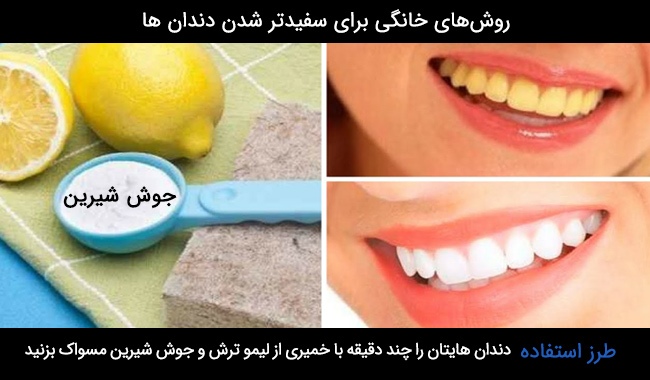 روش های طبیعی برای سفید کردن دندان ها چیست؟