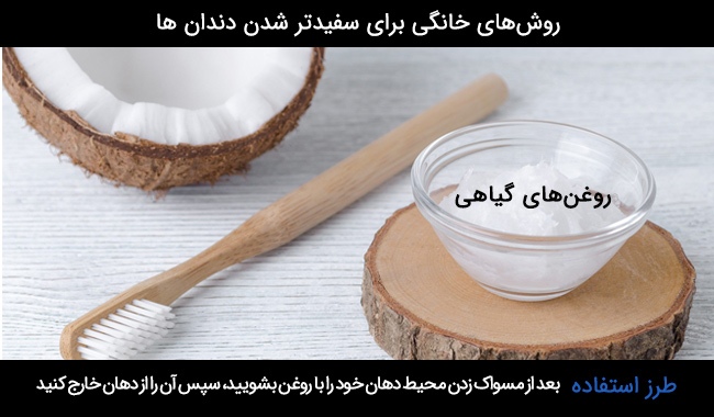 روش های طبیعی برای سفید کردن دندان ها چیست؟ روش های طبیعی برای سفید کردن دندان ها چیست؟