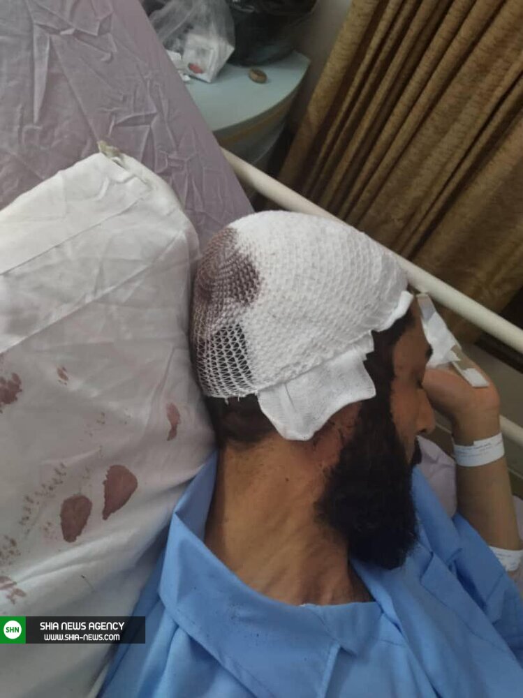 ضرب و شتم و حمله به دو امام جماعت در قم+ تصاویر