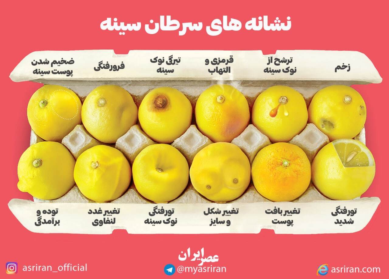 اینفوگرافیک/ نشانه های سرطان سینه اینفوگرافیک/ نشانه های سرطان سینه