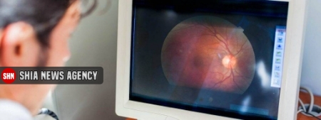 سکته چشم چیست؟ + علل،علائم و راههای درمان