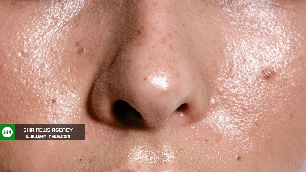 راه حلی ساده برای آب کردن چربی صورت و زیبایی