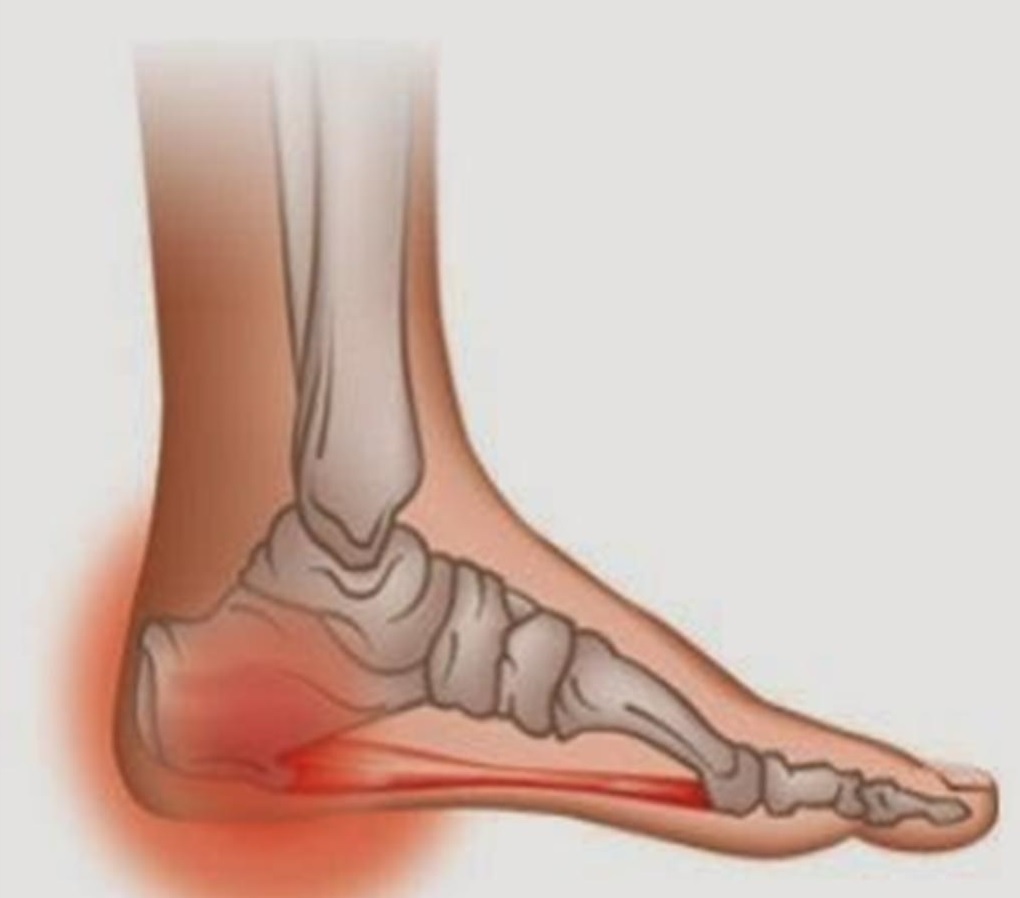علائم و درمان درد صبحگاهی پاها