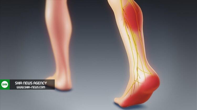 درد پا نشانه چیست؟+ پیشنهادهایی برای درمان پا درد