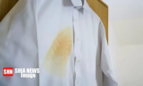 ترفندهای از بین بردن سوختگی لباس با اتو