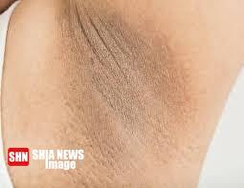 آیا رفع تیرگی زیر بغل یک روزه ممکن است؟