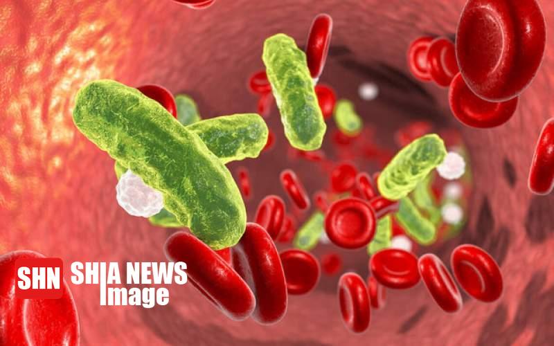 سپسیس چیست؟ | درمان سپسیس سپسیس چیست؟ | درمان سپسیس