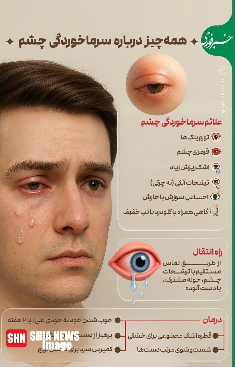 اینفوگرافی/ همه چیز درباره سرماخوردگی چشم اینفوگرافی/ همه چیز درباره سرماخوردگی چشم